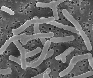 Bifidobacterium
